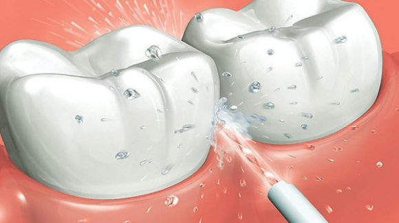 ¿Utilizas la irrigación bucal en tu higiene bucodental?