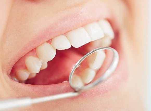 Relación entre periodontitis y la colocación de implantes dentales