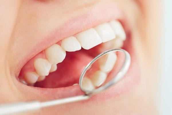 Periodontitis e implantes dentales. Clínica Dental Pilar Garrido.