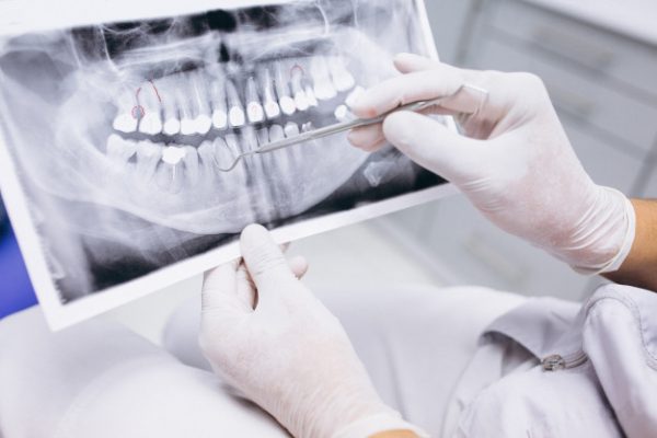 Radiografias dentales. Clínica Dental Pilar Garrido