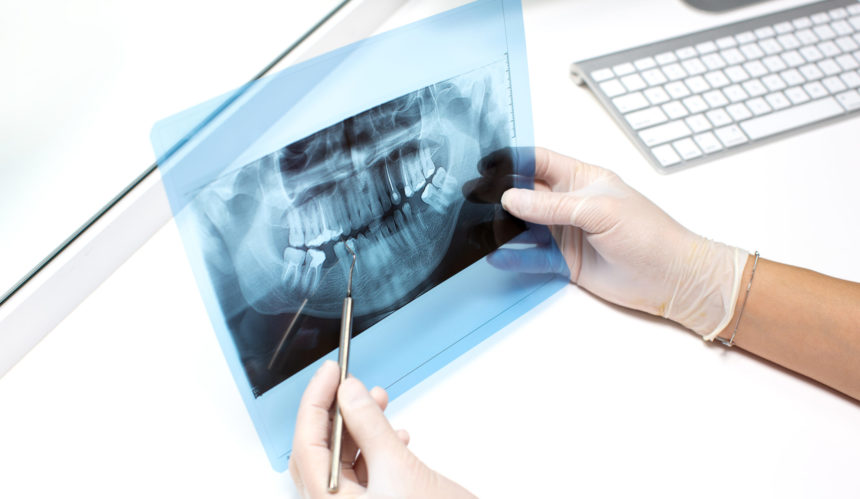 La Inteligencia Artificial en la Odontología