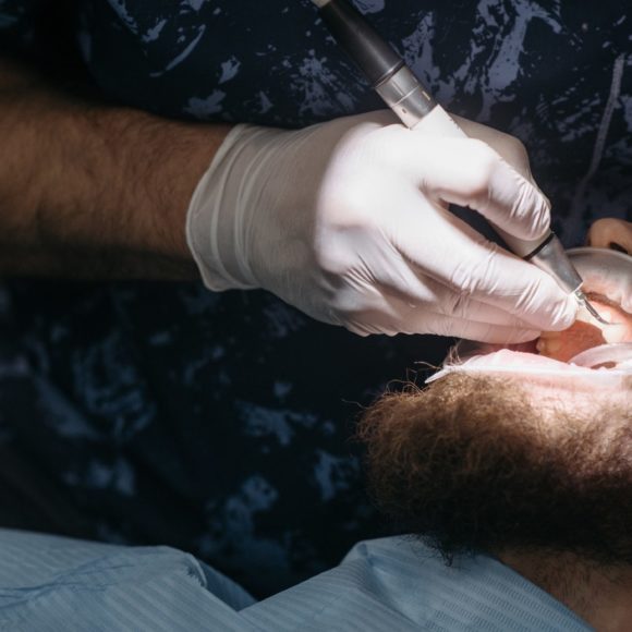 ¿Qué problemas surgen a partir de los implantes dentales?