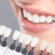 Carillas dentales: el secreto mejor guardado de una sonrisa perfecta