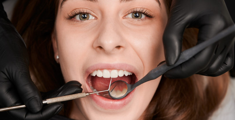 Los implantes dentales en maxilares con poco hueso son una realidad