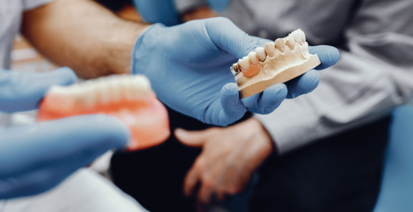 ¿Qué tipos de implantes dentales se adaptan mejor a cada persona?